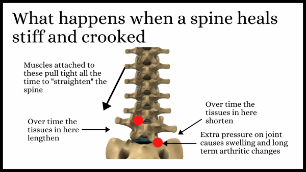 Basic consequences of a dysfunctional spine