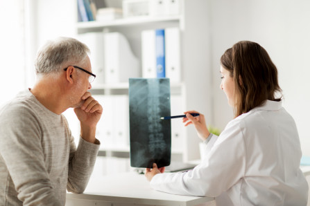 Doctor showing x-ray of spine