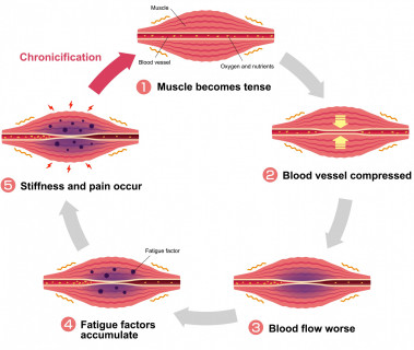 Pressure on blood vessels