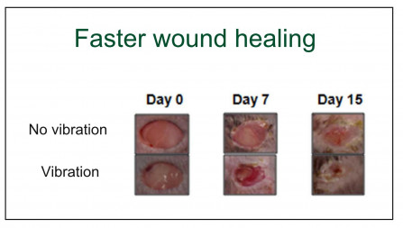 Vibration: faster wound healing