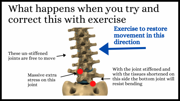 Trying to exercise a spine with a stiffened joint
