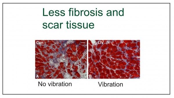 Scar tissue formation: effect of vibration