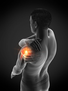 Man with shoulder impingement