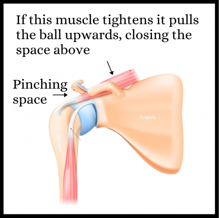 Supraspinatus tightening