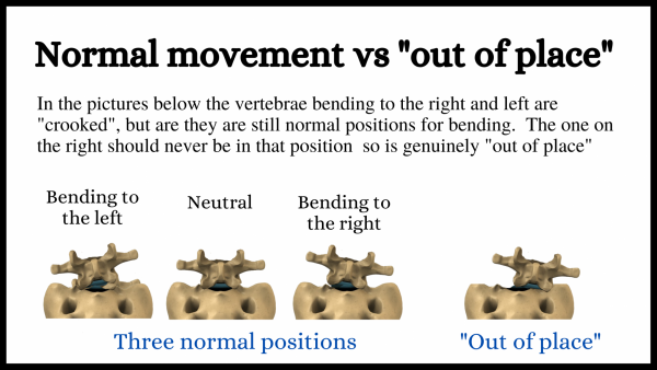 Normal movement vs 