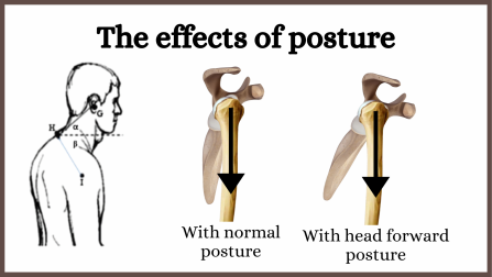 Head forward posture and shoulder balance