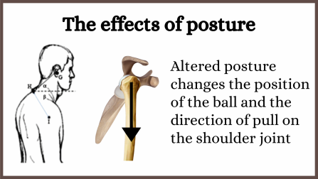 Shoulder position with head forward posture