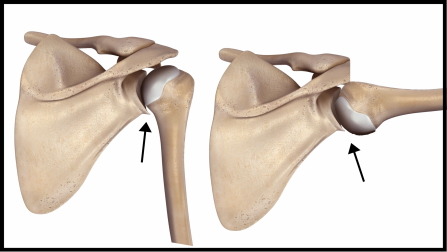 Shoulder joint movement