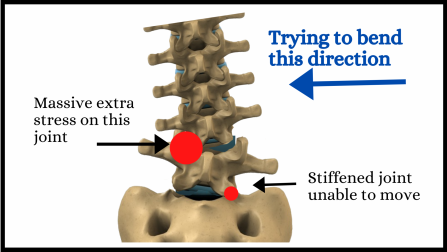 Abnormal spine bending