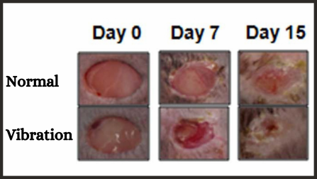 Wound healing example