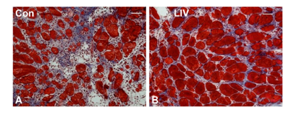 Healing muscle fibrosis