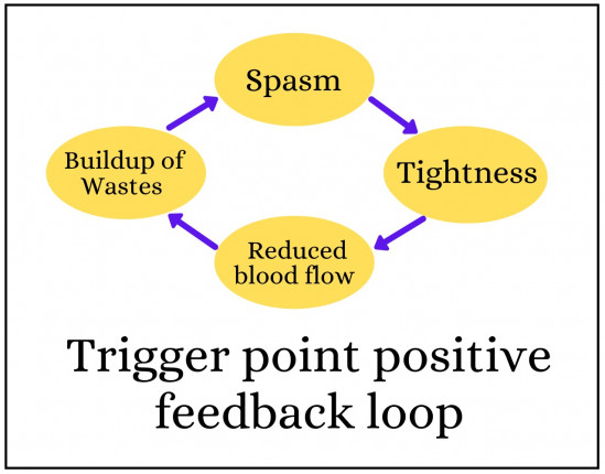 The trigger point positive feedback loop